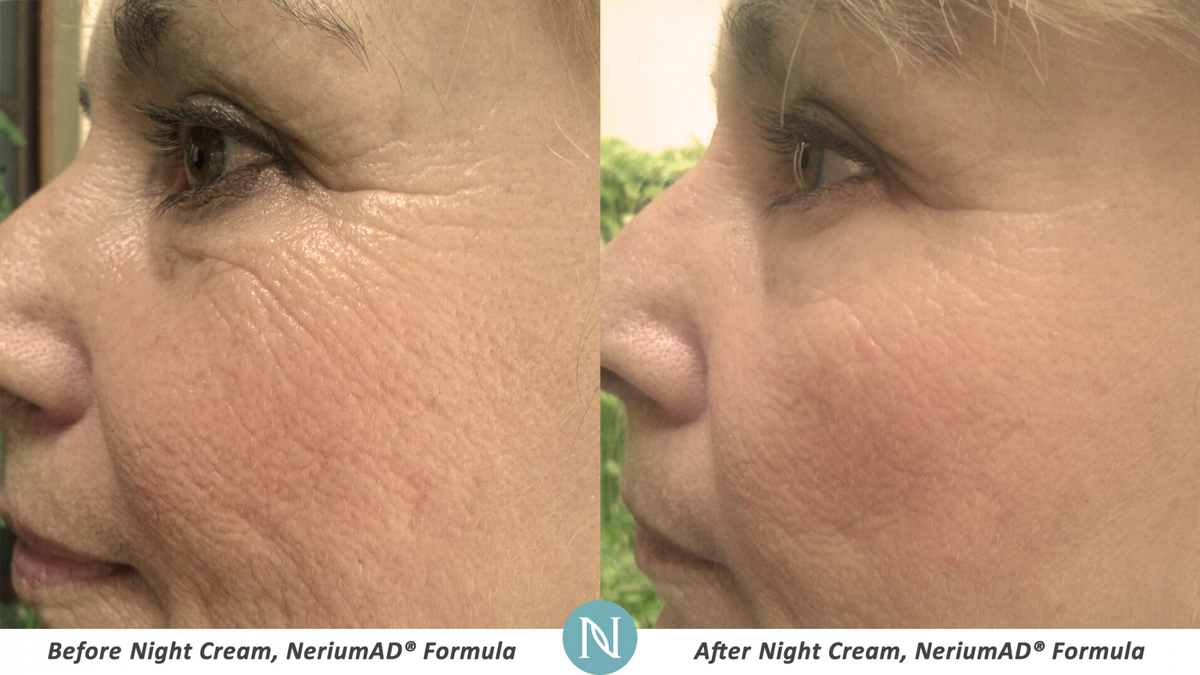 BeautifyNMB's tweet photo. Rejuvenate your life and your skin with Nerium Age-Defying Cream! https://t.co/FI0LwQOXr3 https://t.co/27bKhDCIPC