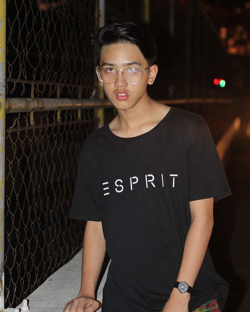 jeeeypee's tweet image. / / E S P R I T / / 
#oilyface