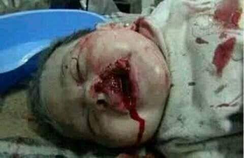 abdallah777712's tweet photo. باي ذنب قتل اين منظمات حقوق الطفل
#امريكا_تقتل_الشعب_اليمني
#USA_Kills_Yemeni_People https://t.co/cDs3zejxMy