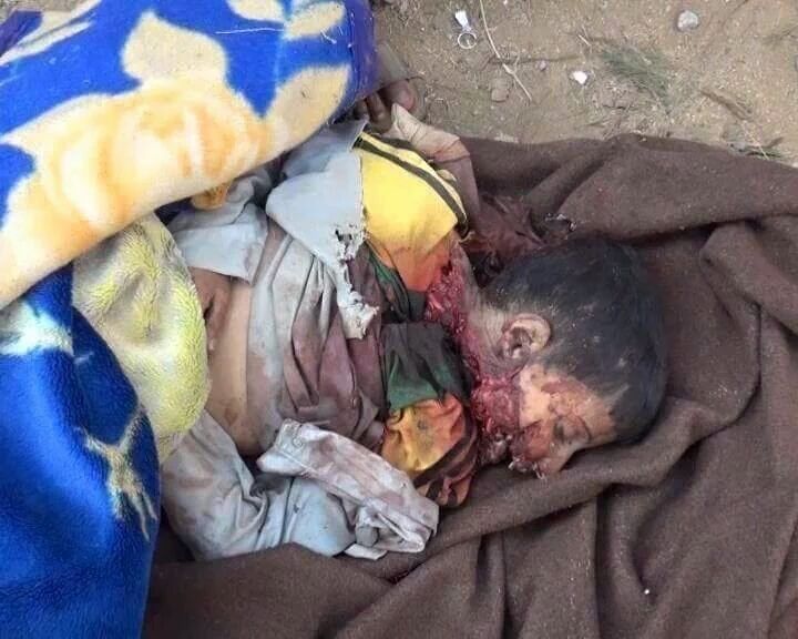 abdallah777712's tweet photo. اذا لم تذبحه. القاعدة. يذبحه الطيران
#امريكا_تقتل_الشعب_اليمني
#USA_Kills_Yemeni_People https://t.co/njPJ8WzWTn