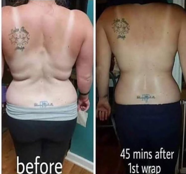 middleton_wraps's tweet photo. After just 45 minutes of using 1 body wrap! Ask me how to get these results!!#itworks #bodywraps #weighloss #fit https://t.co/FPURYvGStK
