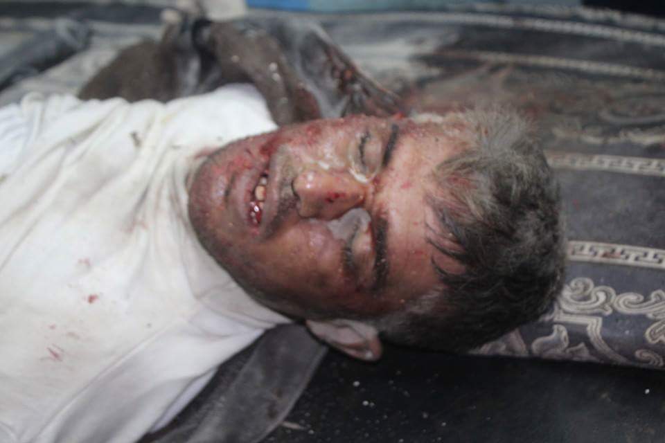 ReporterSyrien's tweet photo. 3 médecins sont toujours sous les décombres de l'hôpital soutenu par @MSF_Syria bombardé par les russes #Russia https://t.co/Z0svO9nwvc