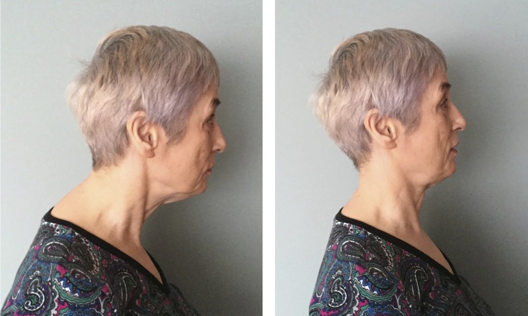 YorkRisingUP's tweet photo. New blog! Tai Chi-Qigong &amp; Fascial Fitness: Say NO to Neanderthal Neck &amp; Quasimodo Crunch! https://t.co/UNwehugYyP https://t.co/oRXW0JaHwA
