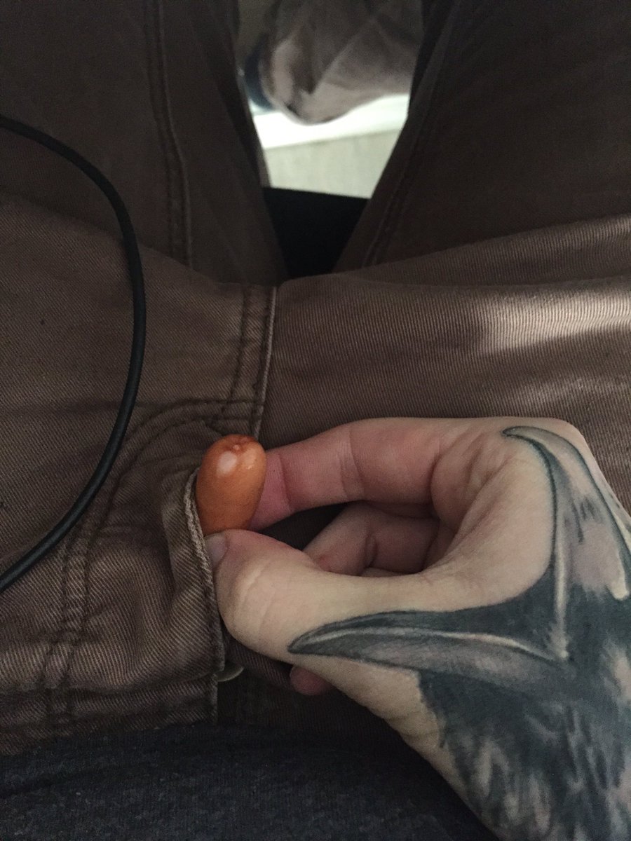 shrocool's tweet image. Leake