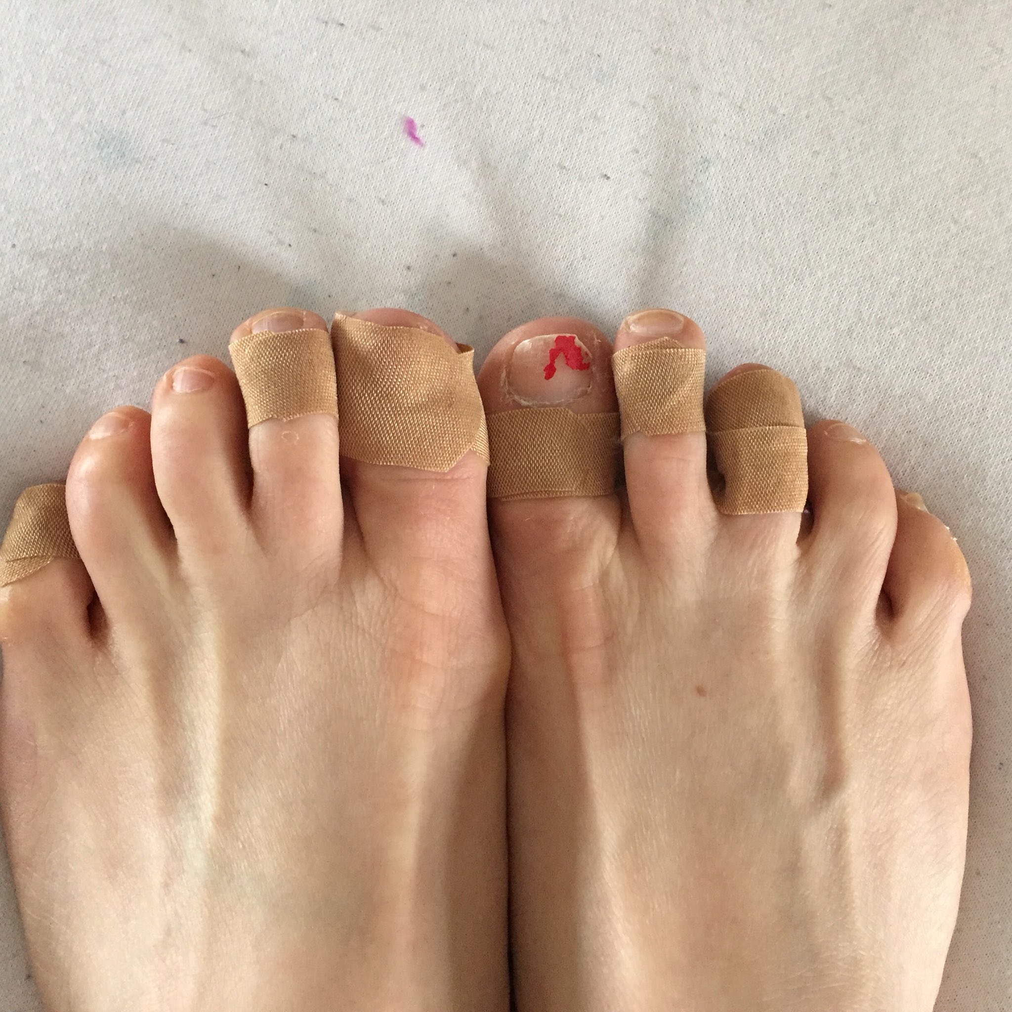 How to Bandage Fingers or Toes: Checking For Breaks + First Aid Tips