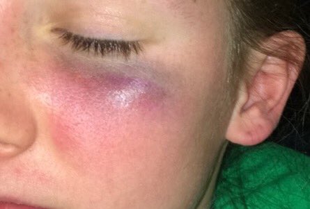 izzy_bowman's tweet photo. go hard or go home #clbl #teamblue https://t.co/0D97V9zBEx