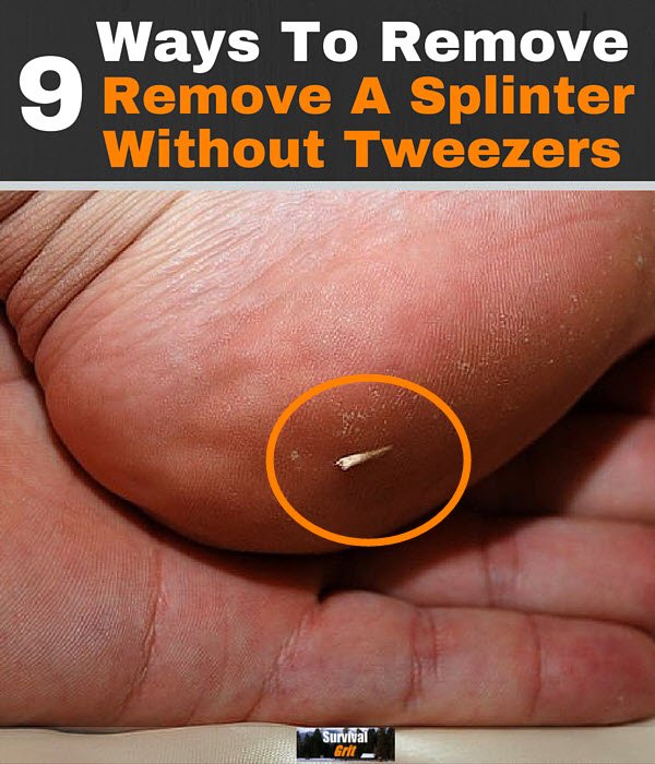 SurvivalGrit's tweet image. 9 Ways to Painlessly Remove a Splinter Without Tweezers buff.ly/1PNg4wv