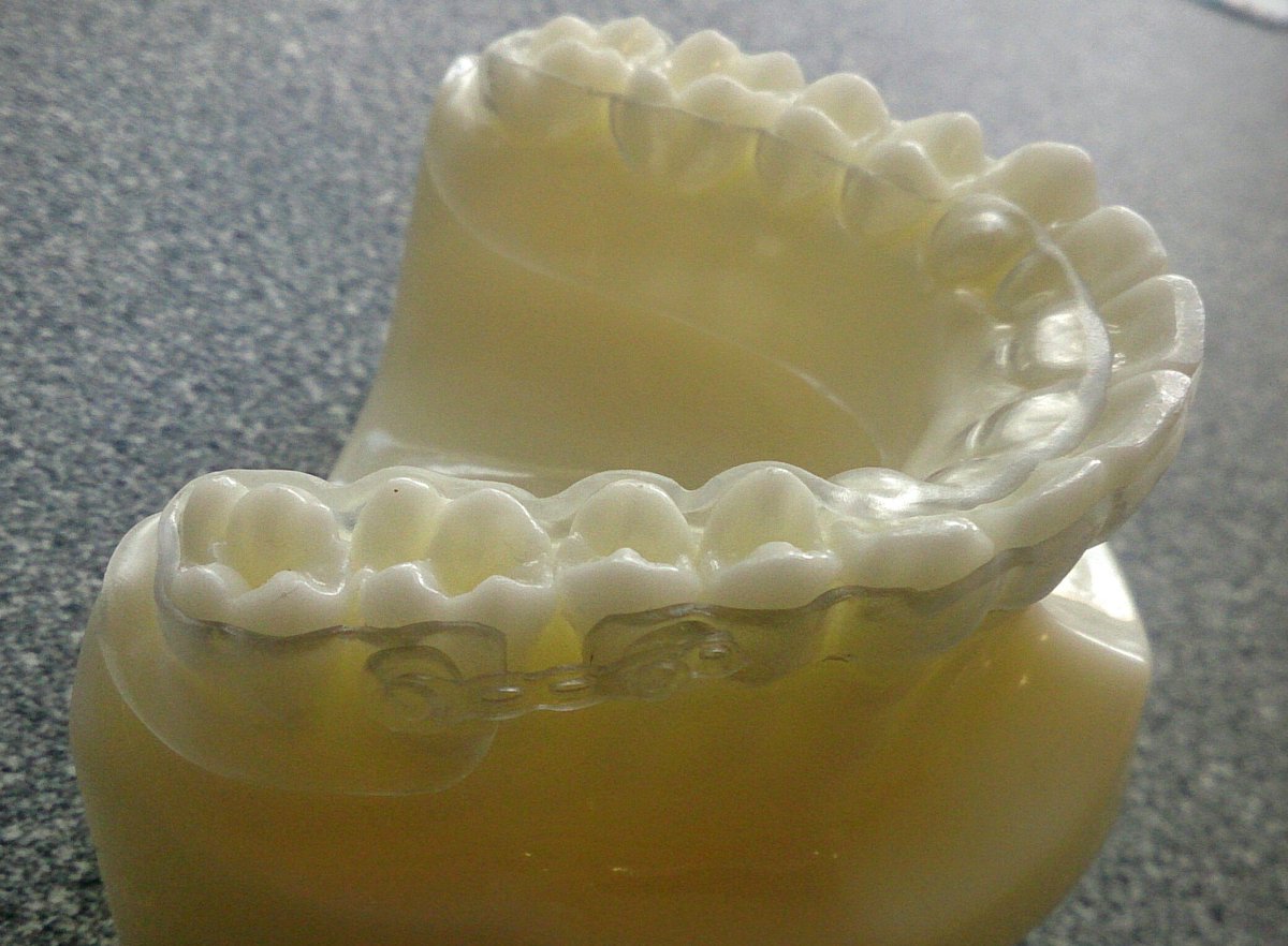 RetainerWorld's tweet image. The #BESSEX retainer! Our unique VFR combining the best qualities of a #BEGG and #ESSIX retainer - for only £15.99