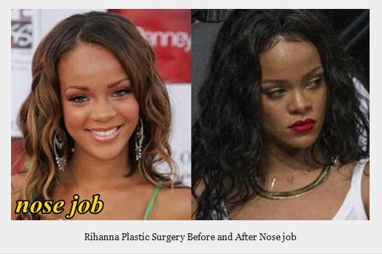 rihanna without makeup before nose job