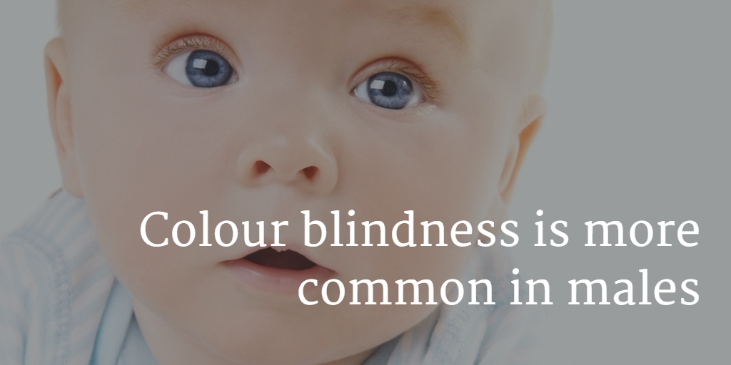 MarioMYoko's tweet image. RT  #OptometryCE on Twitter #EyeFacts #Optometry