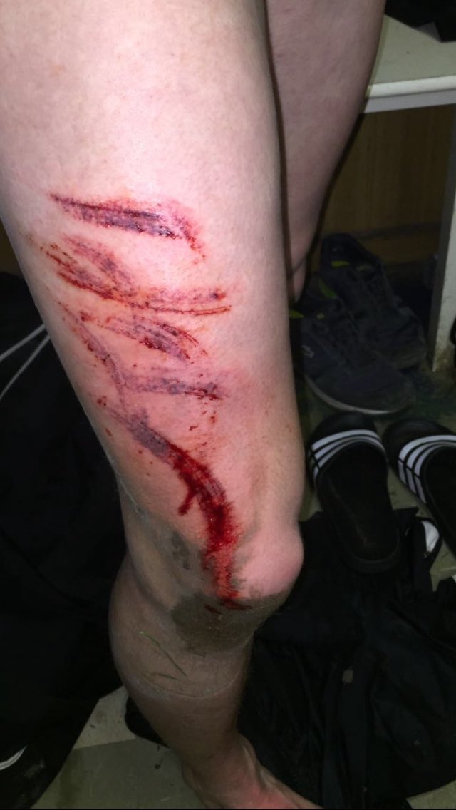FCFleetTown's tweet photo. Let's hope @jfrancis_96 can recover after this! #notevenabooking 😂😂😂 https://t.co/5RuV5g9fIX