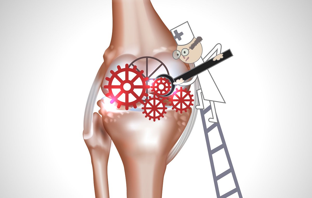 ZAGrrl's tweet photo. Breakthrough #Tech Offers Alternatives to #Knee #Replacement https://t.co/UXCFtRTJ5J #OA #Cartiheal #Startups https://t.co/Pbd3vHAYRZ