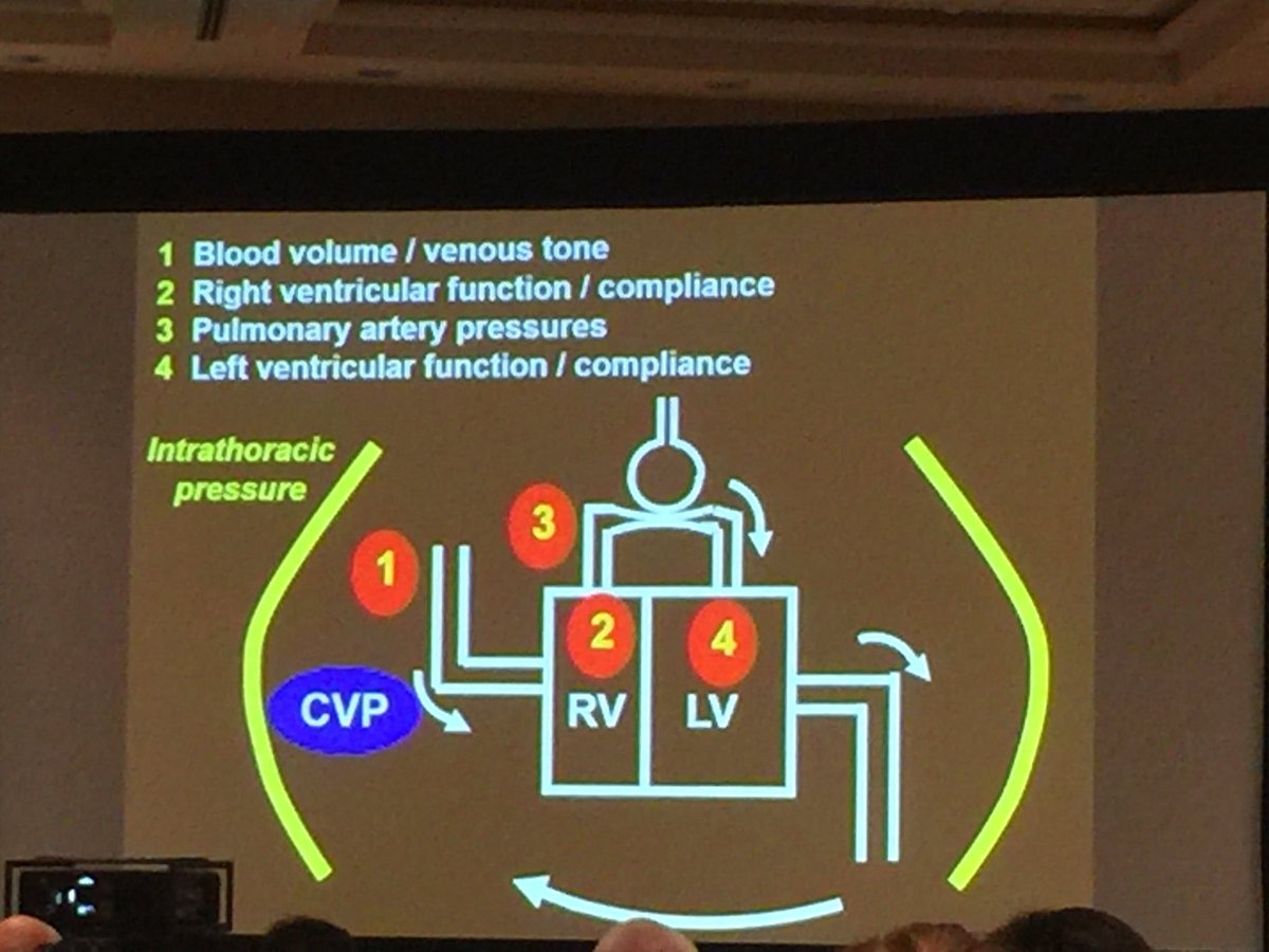 Drmanoj_s's tweet photo. #CCC45 #sccm2016 JLV:CVP not useless, we don't understand it well enough! More complex that it seems!Same w PA cath https://t.co/DwdcFMB5Kr