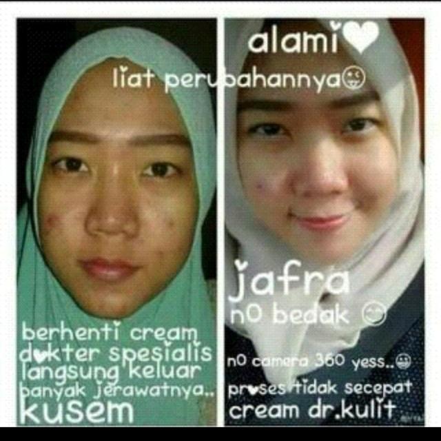 Ochapinker's tweet photo. Beralihlah memakai JAFRA
Line: yulfia.roza https://t.co/pkqCV8Dl0l