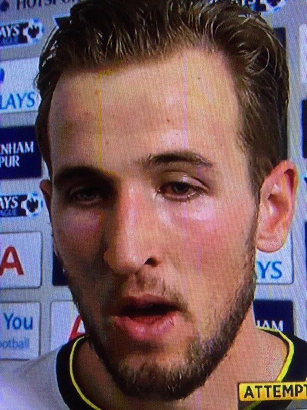 Harry Kane looks like the sort of guy who'd be distracted by some jingling keys and some shiny tinfoil.