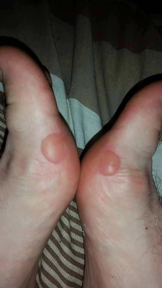 105 Miles in 5 Days.  You even run in your sleep.
telford-live.com/2016/02/shawbi…