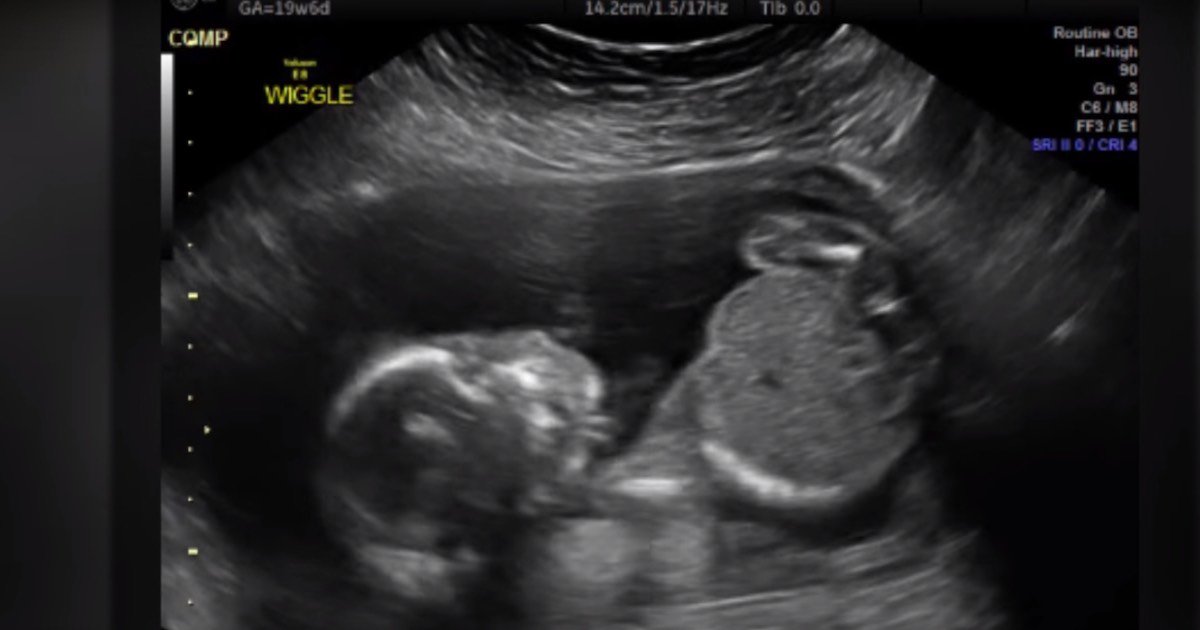 Keith Estiler tweet media