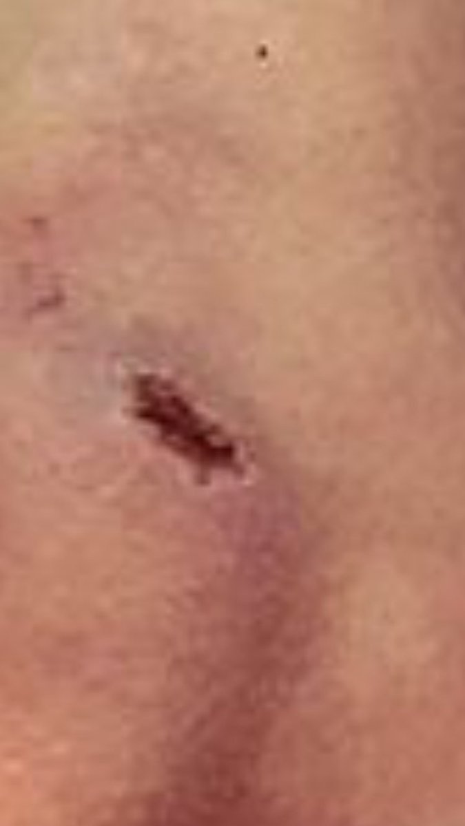reallynotcoachp's tweet photo. Even in soccer, second base manages to drag me to the ground #itrippedoversecond https://t.co/5oxkRQcqD4