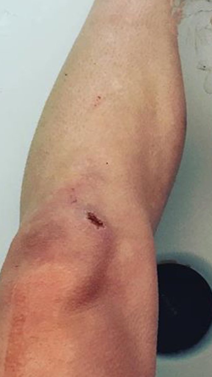 reallynotcoachp's tweet photo. Even in soccer, second base manages to drag me to the ground #itrippedoversecond https://t.co/5oxkRQcqD4