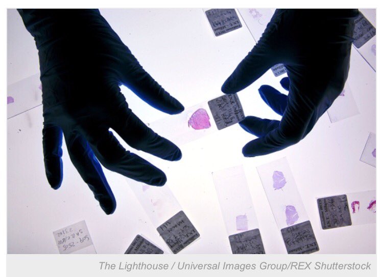 tarin1977's tweet photo. The beginning of the end of using #Cancer #cell_lines? https://t.co/ZDMIipAPkV @NatureNews https://t.co/AVrPA8qBBH