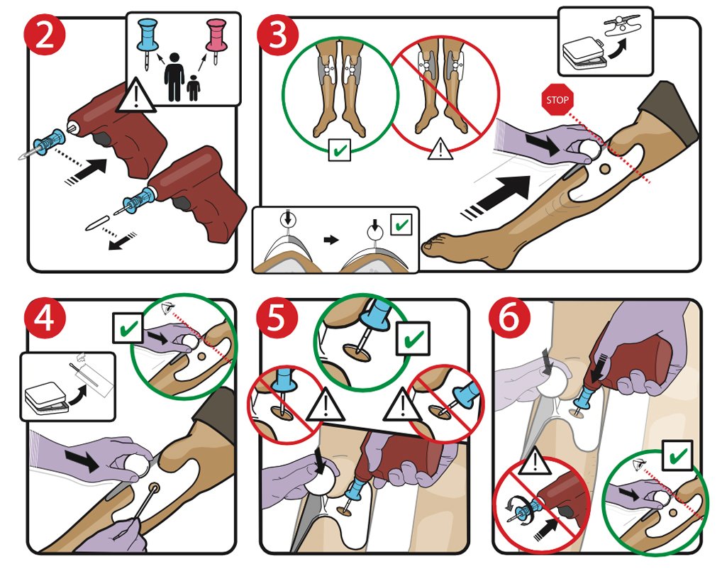 FUNNELINC's tweet photo. Even doctors need help similar to airplane #safety cards before drilling into your tibia (our client: Dartmouth) https://t.co/dxrZRwoion