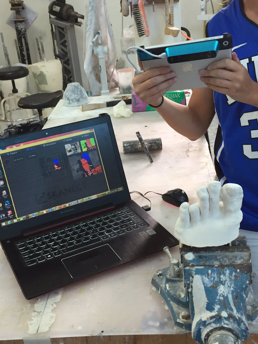 Using <a href="/Skanect/">Skanect</a> with <a href="/structure/">Structure</a> scanner to capture mold of a toe amputation --> fabricate the silicone prosthesis.