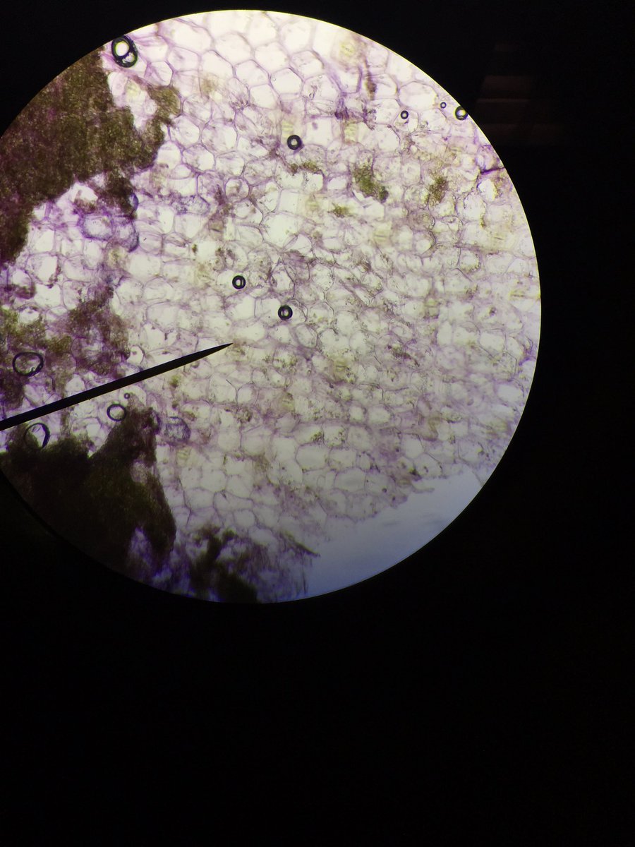 Zaymister7's tweet photo. A picture of plasmolysis taking place in the cells of a leaf of a Zebrina plant #CummingsWeek6 @UNKBiol106AC https://t.co/vkZpOTP399