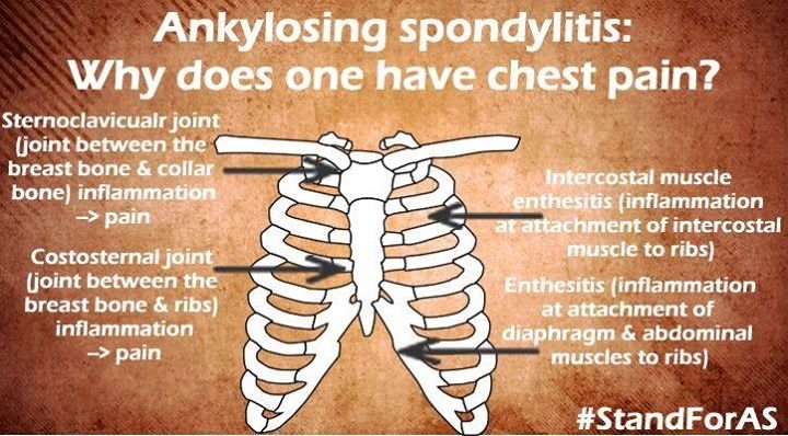 pain in centre of chest between breasts pain in centre of chest between breasts