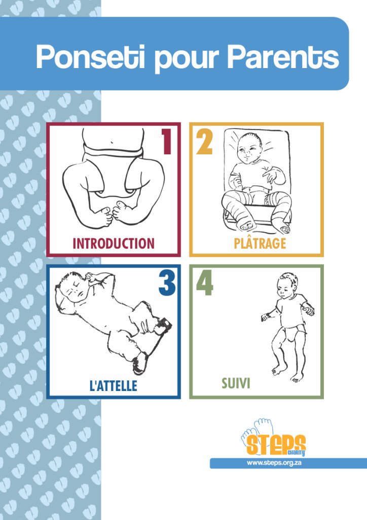 STEPS_SA's tweet photo. Ponseti pour Parents https://t.co/PxQwrwPSUr #piedbot #clubfoot https://t.co/jXcGm6Czpu