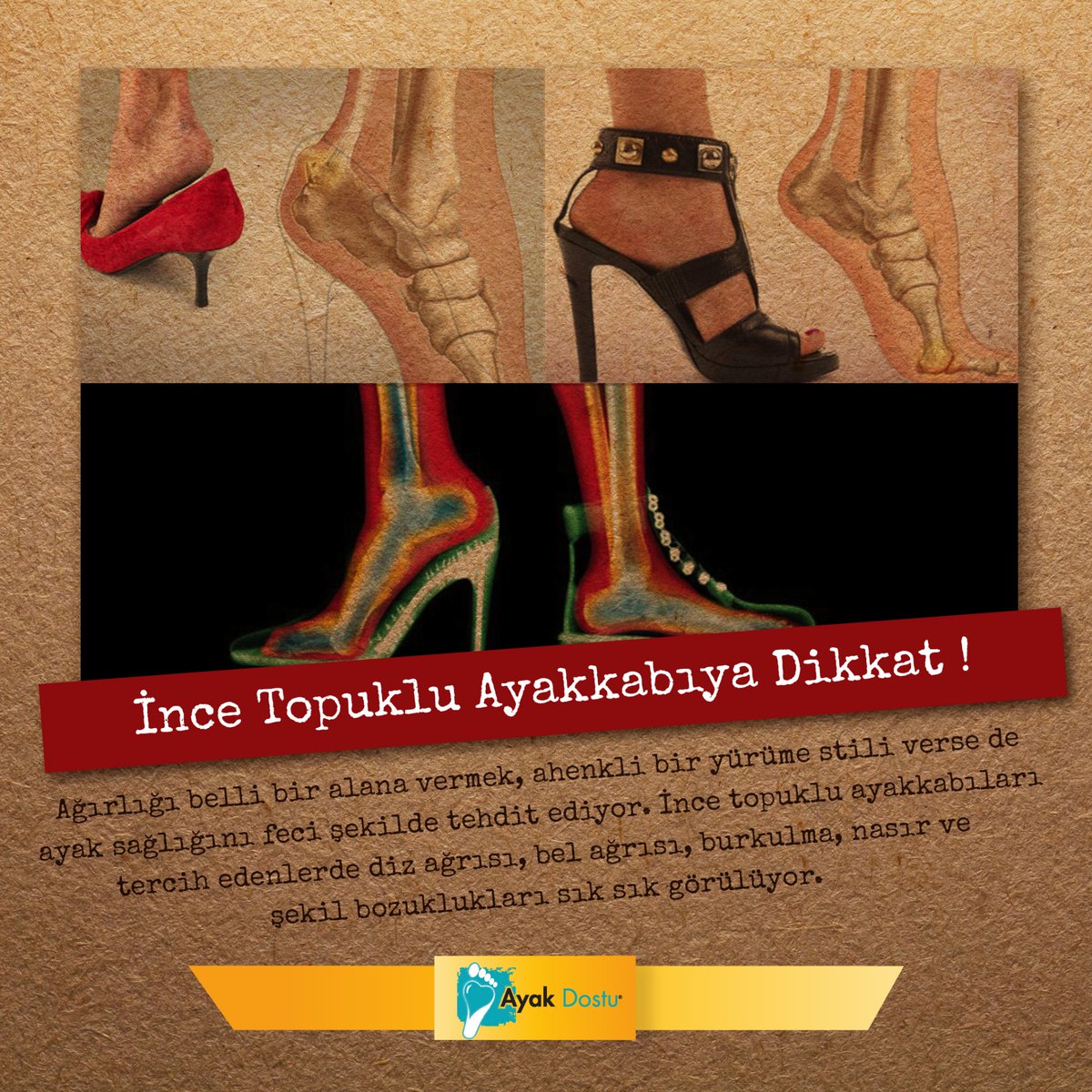 Ağırlığı belli bir alana vermek, ayak sağlığını feci şekilde tehdit ediyor.
#ayakdostu #topuklu #ayakcı