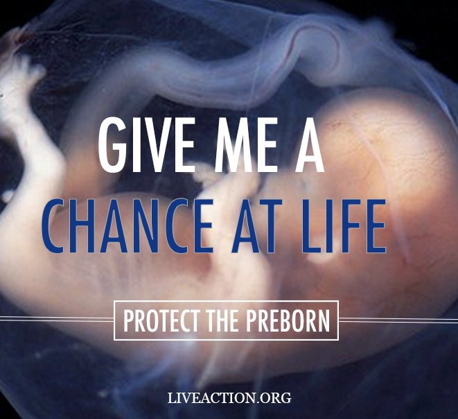 Every child deserves a chance at life. #RT if you agree!