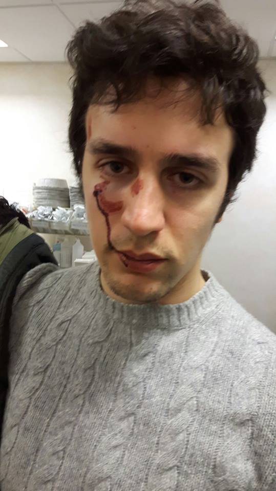 reteconoscenza's tweet photo. #nessunospazio! Aggressione fascista a #Roma Tor Vergata - H. 17 assemblea pubblica! https://t.co/do9sQlK0ri https://t.co/st1ohfs6zD