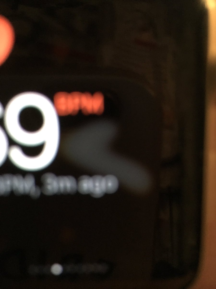 MemorysOfTruth's tweet image. Is this mark normal on an #AppleWatch @AppleSupportUK just purchased it?