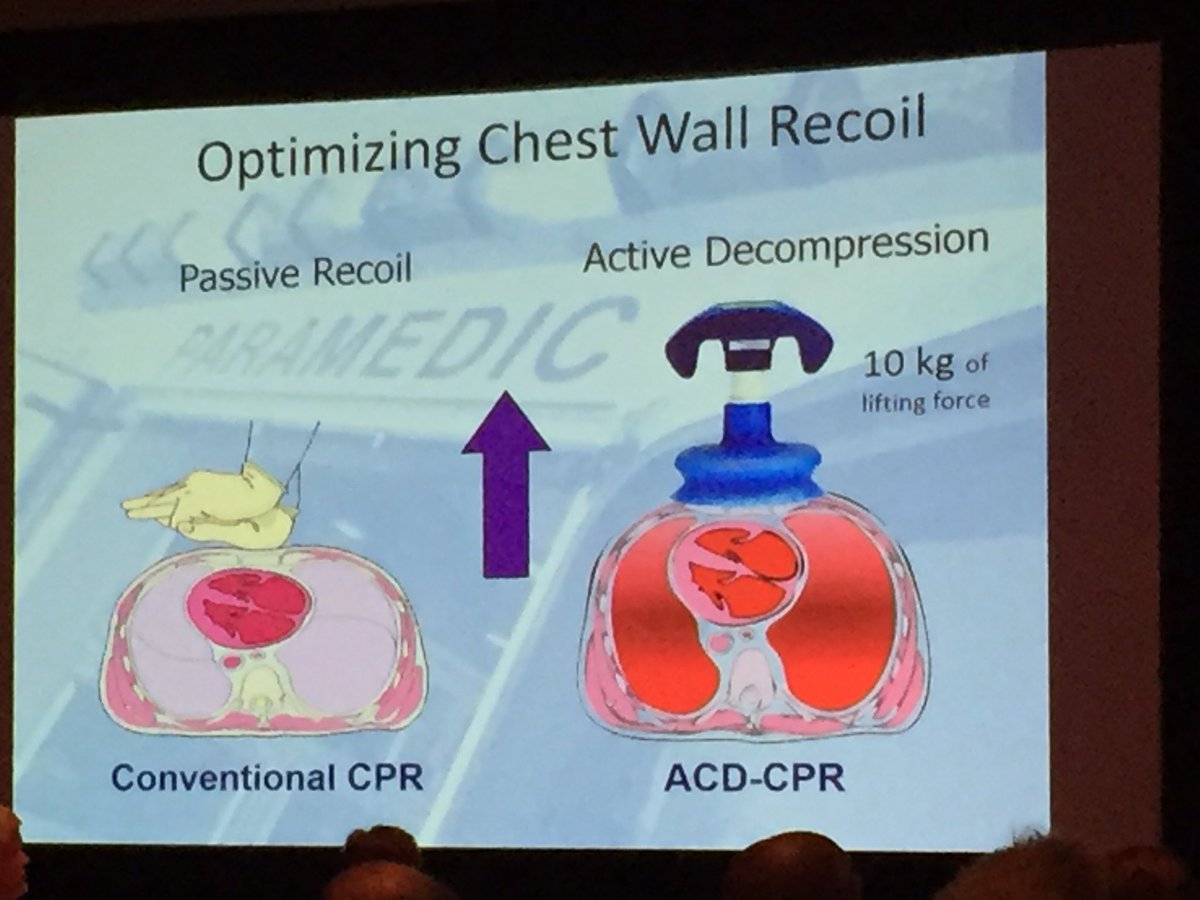 EMS_Nation's tweet image. Understanding physiology of Active Compression Decompression for ⬆️Preload @EaglesGather #GatheringEagles16 #FOAMems