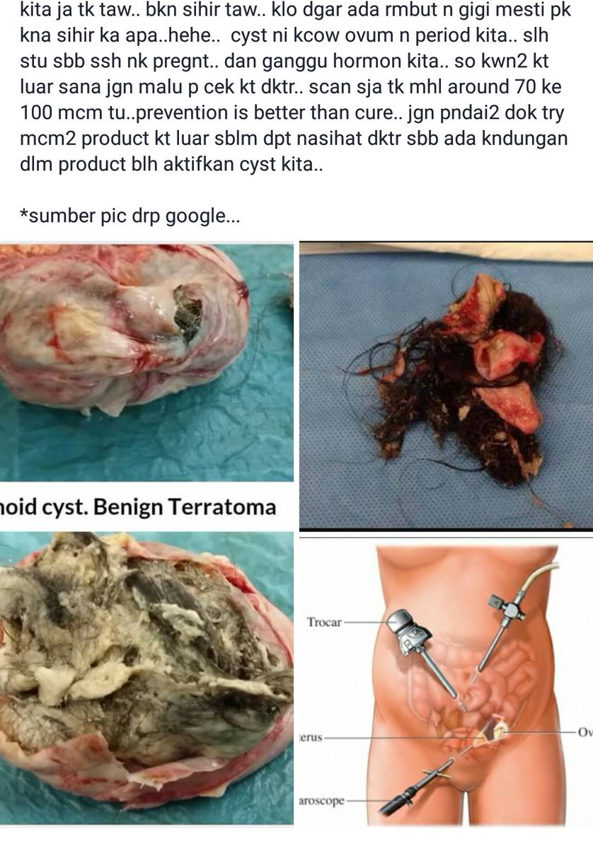 mchaelimm's tweet photo. Awak awak yg dah diet tapi tak kurus kurus pastu tak dtg period dlm tempoh yg lama. Elok baca ni. 😱 https://t.co/VSGnMePmaL