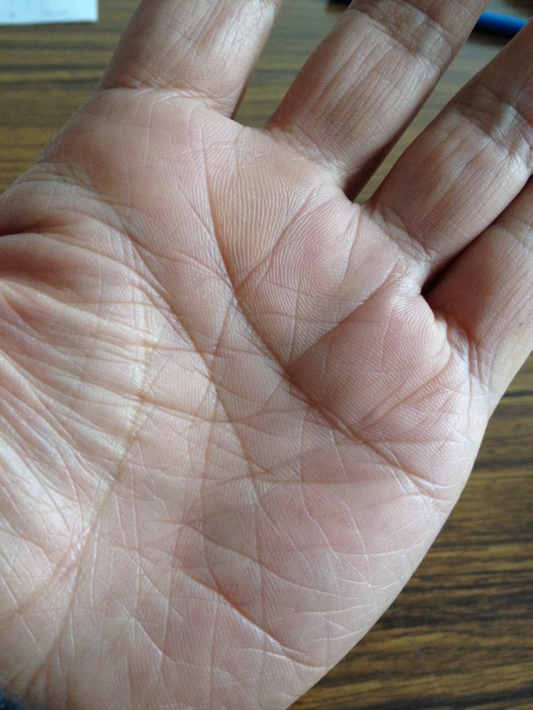 上條クニトシ٩ ᐛ 2重仏眼で神秘十字がある私は霊感が開花していて直感力が働くらしい W 笑 手相って当たるんですか 親指の第一関節に 仏眼 のある手相は霊感が強いらしい Line News T Co Rpvmgtul1r T Co Iipichmmoo Twitter