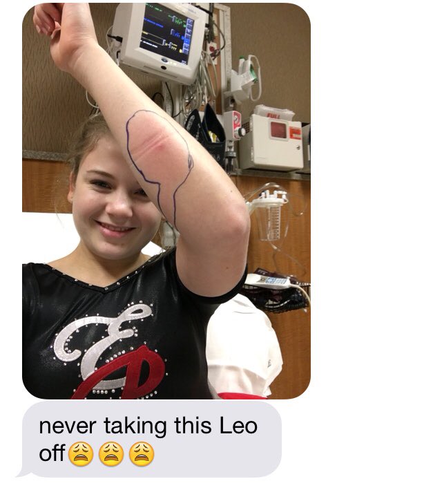 EPHSGYM's tweet photo. Unfortunately @C_Steidle6 made a trip to the ER tonight, but at least she's reppin' EP 😍🙌 #nevertakeofftheleo https://t.co/YrAixzv81w