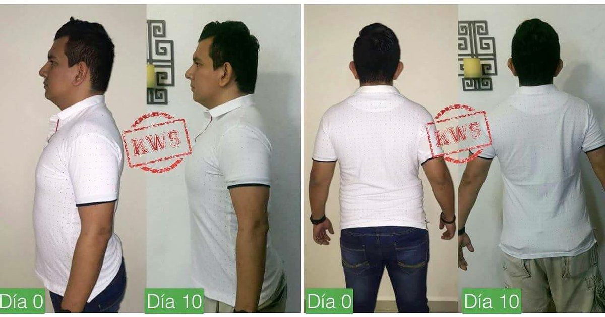 bichota_697's tweet photo. Felicidades a #SamuelLuna que después de 10 días supo los beneficios de una postura correcta 👏🏻👏🏻👏🏻👏🏻 https://t.co/lMEXJzddok