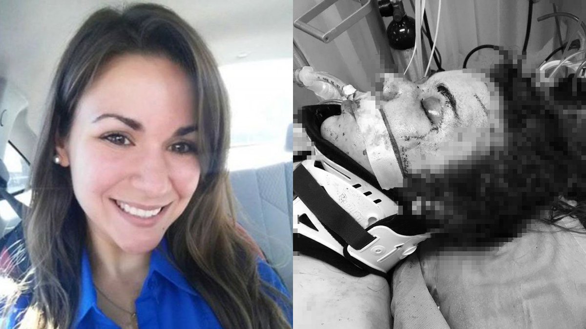 .@Craigslist roommate nearly kills 23-year-old woman bit.ly/1OlGgfC?utm_me… https://t.co/UVEhBQLhcL