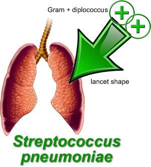 imindmaps's tweet image. Streptococcus pneumoniae is the most common organism for bacterial meningitis after 1 month of age. #USMLE