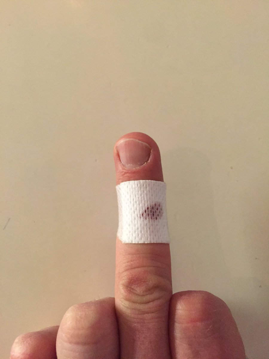 FridJohan's tweet photo. @Gurras Tack som Faan för den nya globalkniven #Aj! https://t.co/rQ0vutTqH4