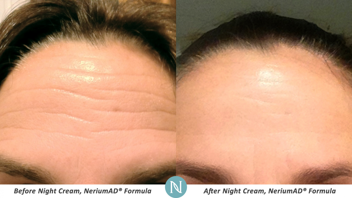 BeautifyNMB's tweet photo. No need to fear aging with Nerium Age-Defying Cream: https://t.co/J4y3DTSUA4 https://t.co/fyKtMUJqEH
