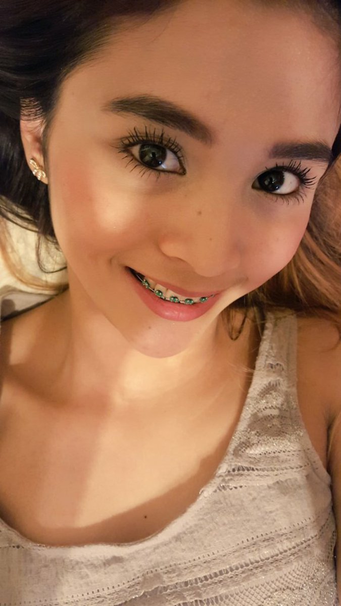 braces girl thoughtful moment