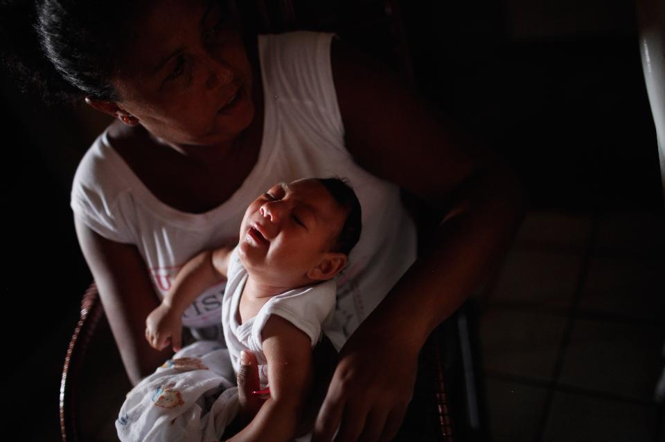 Forbes's tweet image. If not for microcephaly, “we wouldn’t be here talking about Zika." onforb.es/1mKG8zX
