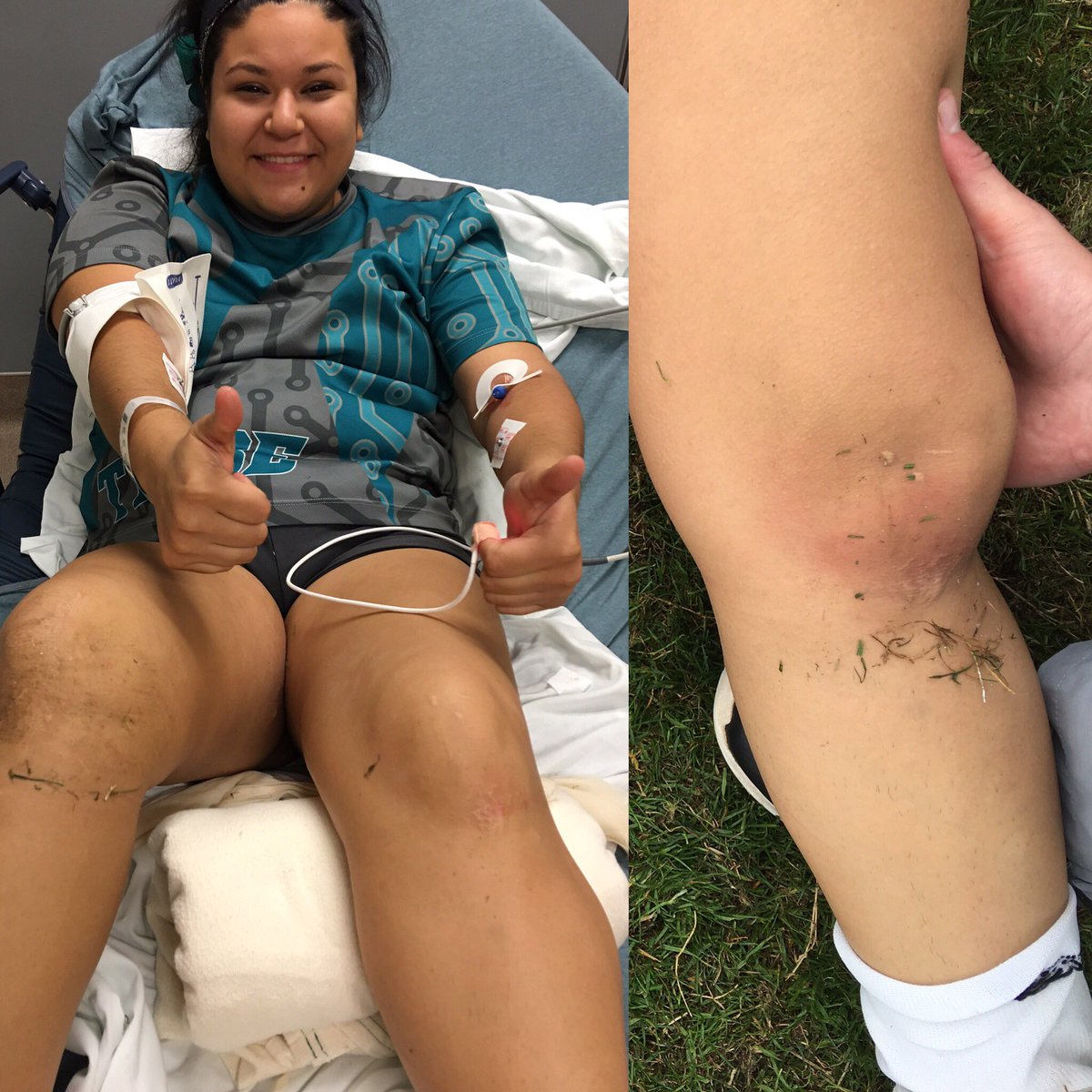 TribeQuidditch's tweet photo. Shout out to our MVP @mduenas17 not only is she cute, but she's tough on the pitch! #DislocatedPatella #NoBiggie https://t.co/KWzVlQEWch