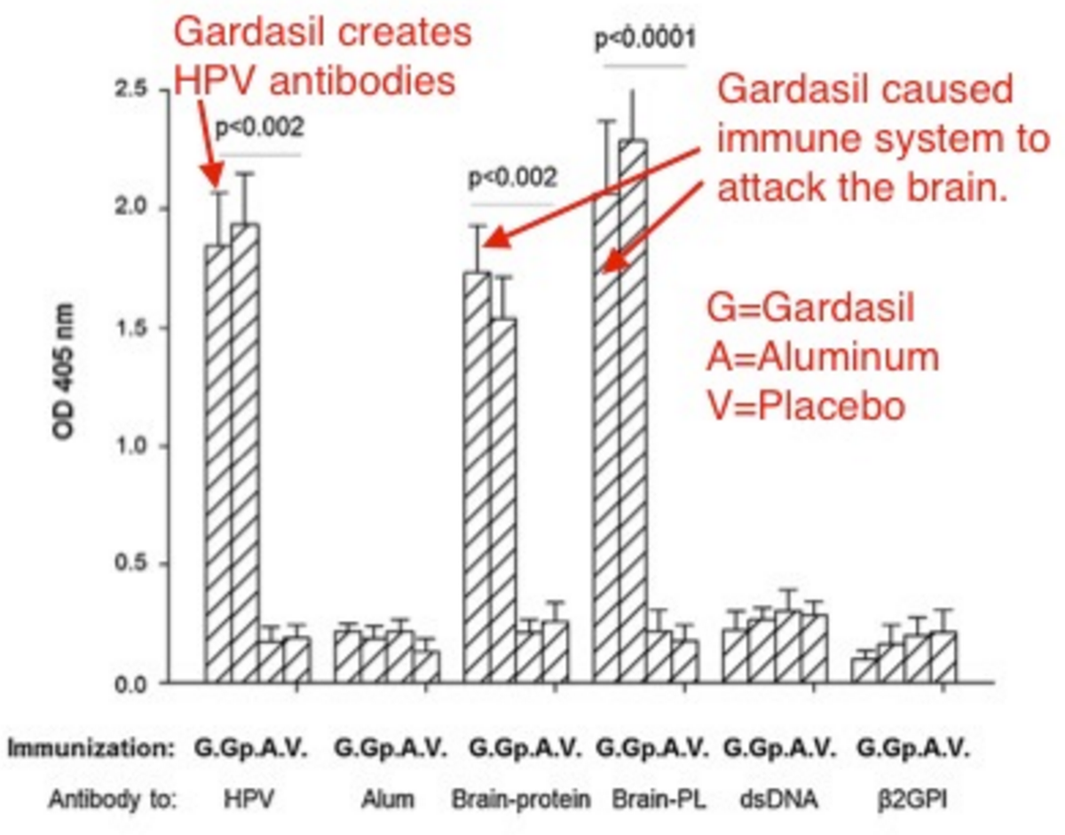 VaccineXchange's tweet photo. RT @VaxCalc: Important new study ☛ Brain Damage from Low-Dose Aluminum Adjuvant and Gardasil https://t.co/EOm8SX3dFE https://t.co/86vpff8kfo