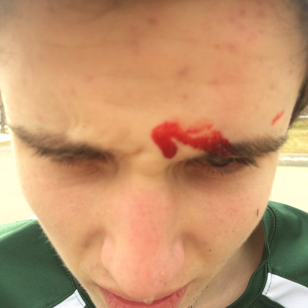 T_vitko45's tweet image. #backyardball