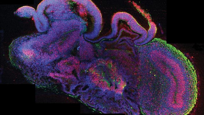 SBSNews's tweet photo. Researchers report possible breakthrough in hunt for Motor Neurone Disease cure https://t.co/nrAc6LbLVp https://t.co/m0Bpe8U5b0
