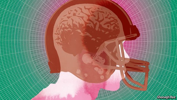 TheEconomist's tweet photo. Children with a sports-related concussion still had impaired brain function two years later https://t.co/XtunCiob3H https://t.co/oz4DXKzl1q