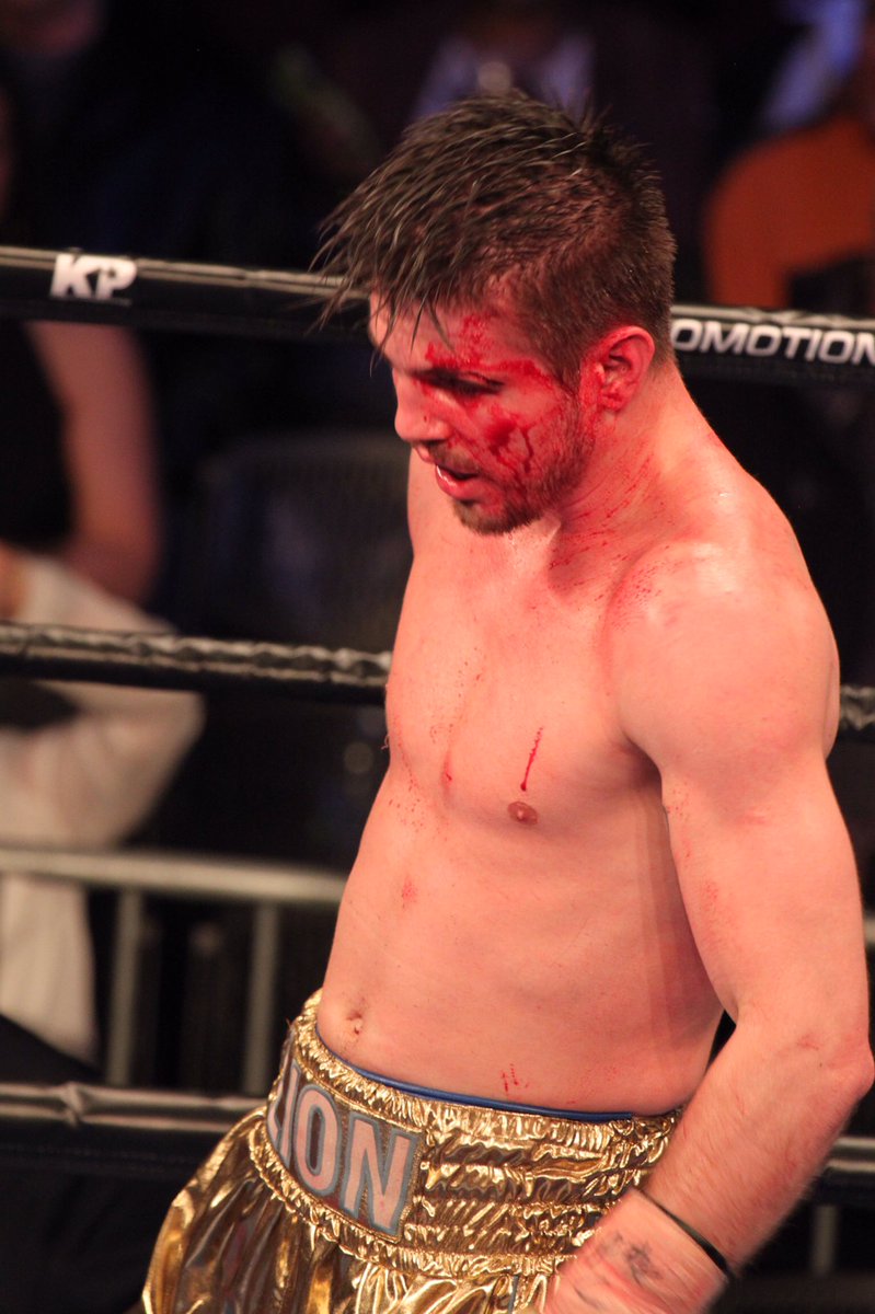 scarecrowgrin's tweet photo. U don't play boxing #bleedlikeus #boxing #ukraine #bethlehem #shobox #WilliamsMatano https://t.co/Lww2g5FBZr